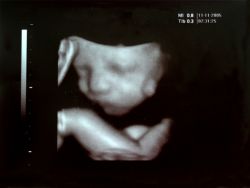 Ultrasound Image